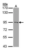 Anti-RASAL1 antibody [C1C3] used in Western Blot (WB). GTX109520