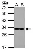 Anti-EIF2B1 antibody used in Western Blot (WB). GTX109525