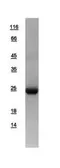 Human Beta A4 Crystallin protein, His tag. GTX109526-pro