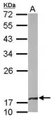 Anti-beta A4 Crystallin antibody [N1C3-2] used in Western Blot (WB). GTX109526