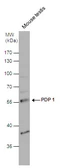 Anti-PDP1 antibody [N1N3] used in Western Blot (WB). GTX109533