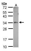 Anti-PEX26 antibody used in Western Blot (WB). GTX109551