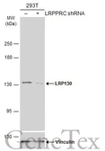 Anti-LRP130 antibody [N3C2], Internal used in Western Blot (WB). GTX109558