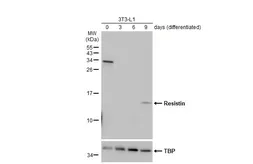 Anti-Resistin antibody [N1C3] used in Western Blot (WB). GTX109562