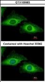 Anti-PDCD5 antibody [N1C3] used in Immunocytochemistry/ Immunofluorescence (ICC/IF). GTX109563