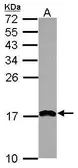 Anti-PDCD5 antibody [N1C3] used in Western Blot (WB). GTX109563