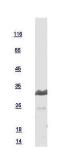 Human CHMP4B protein, His tag. GTX109564-pro