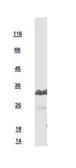 Human CHMP4B protein, His tag. GTX109564-pro