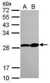 Anti-Proteasome 20S beta 3 antibody [N1C3] used in Western Blot (WB). GTX109566