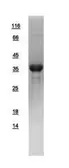 Human AKR1B10 protein, His tag. GTX109571-pro