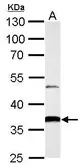 Anti-AKR1B10 antibody used in Western Blot (WB). GTX109571