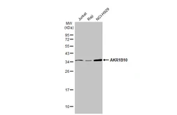 Anti-AKR1B10 antibody used in Western Blot (WB). GTX109571