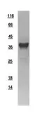 Human GRHPR protein, His tag. GTX109575-pro