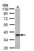 Anti-GRHPR antibody [N1C3] used in Western Blot (WB). GTX109575