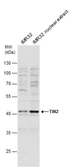 Anti-TIN2 antibody [N1C3] used in Western Blot (WB). GTX109576