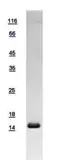 Human Hemoglobin Gamma A protein, His tag. GTX109578-pro