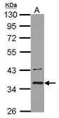 Anti-BRCC36 antibody [N1C3] used in Western Blot (WB). GTX109581