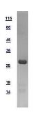 Human PGAM2 protein, His tag. GTX109582-pro