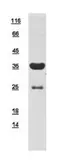 Human Troponin T1 (slow) skeletal muscle protein, His tag. GTX109585-pro