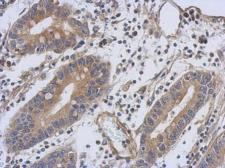 Anti-Troponin T1 (slow) skeletal muscle antibody used in IHC (Paraffin sections) (IHC-P). GTX109585