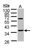 Anti-Troponin T1 (slow) skeletal muscle antibody used in Western Blot (WB). GTX109585