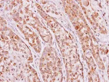 Anti-Ketohexokinase antibody [N1C3] used in IHC (Paraffin sections) (IHC-P). GTX109591