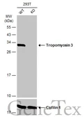 Anti-Tropomyosin 3 antibody used in Western Blot (WB). GTX109592