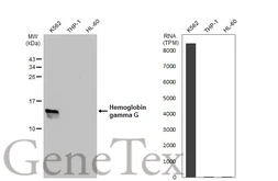 Anti-Hemoglobin gamma G antibody used in Western Blot (WB). GTX109601