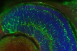 Anti-PSMC3 antibody [N1C2] used in IHC (Whole mount) (IHC-Wm). GTX109605