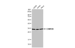 Anti-CHMP2B antibody used in Western Blot (WB). GTX109610