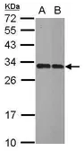 Anti-IMPA1 antibody used in Western Blot (WB). GTX109616
