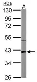Anti-p53R2 antibody [N1C3] used in Western Blot (WB). GTX109620