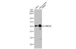Anti-XRCC4 antibody used in Western Blot (WB). GTX109632