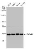Anti-RbAp46 antibody [N1], N-term used in Western Blot (WB). GTX109640