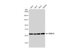 Anti-HDAC2 antibody used in Western Blot (WB). GTX109642