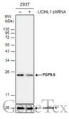 Anti-PGP9.5 antibody used in Western Blot (WB). GTX109646