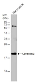 Anti-Caveolin 3 antibody [N1N2], N-term used in Western Blot (WB). GTX109650