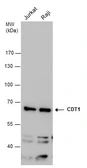 Anti-CDT1 antibody used in Western Blot (WB). GTX109663