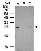 Anti-RAB5A antibody used in Immunoprecipitation (IP). GTX109665