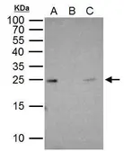 Anti-RAB5A antibody used in Immunoprecipitation (IP). GTX109665