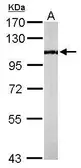 Anti-PCAF antibody [C3], C-term used in Western Blot (WB). GTX109666