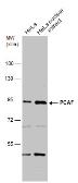Anti-PCAF antibody [C3], C-term used in Western Blot (WB). GTX109666