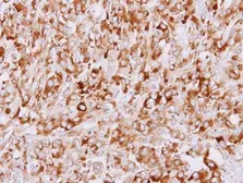 Anti-STUB1 antibody [C1C3] used in IHC (Paraffin sections) (IHC-P). GTX109676