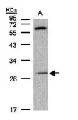 Anti-PHOX2B antibody used in Western Blot (WB). GTX109677
