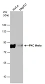 Anti-PKC theta antibody used in Western Blot (WB). GTX109690