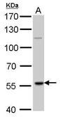 Anti-RAG2 antibody used in Western Blot (WB). GTX109710