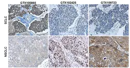 Anti-Cytokeratin 7 antibody [N1C2] used in IHC (Paraffin sections) (IHC-P). GTX109723