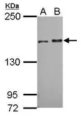 Anti-SMC1A antibody [N1N2], N-term used in Western Blot (WB). GTX109724