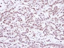 Anti-SMC1A antibody [N1N2], N-term used in IHC (Paraffin sections) (IHC-P). GTX109724