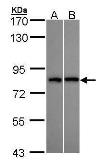 Anti-DDX3 antibody used in Western Blot (WB). GTX109727
